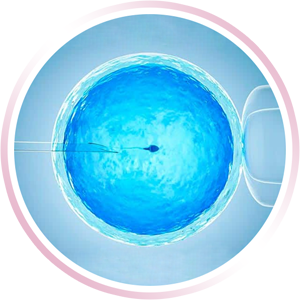 ICSI